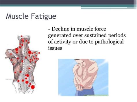 Fatigue and Muscle Pain