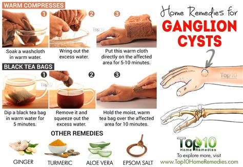 ganglion cyst ankle home remedies