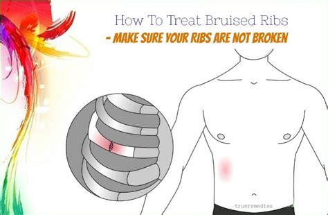 Healing Bruised Ribs