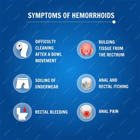 Hemorrhoids