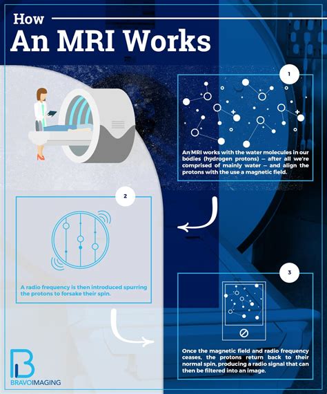 MRI process