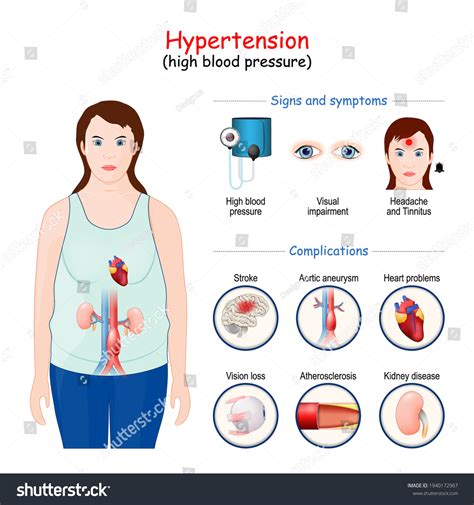 Hypertension complications in women