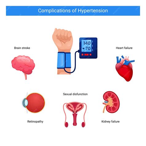 Hypertension in women