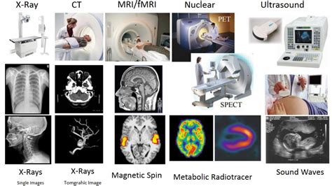 Imaging Modalities