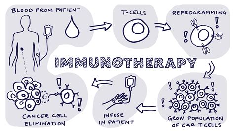 Immunotherapy for Skin Cancer