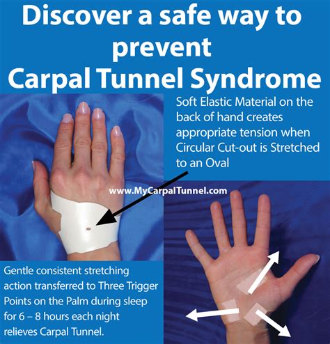 Injury prevention for carpal tunnel