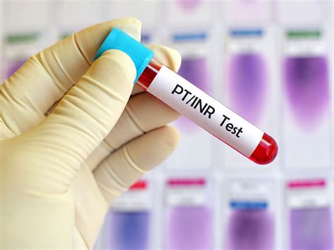 INR Blood Test Monitoring