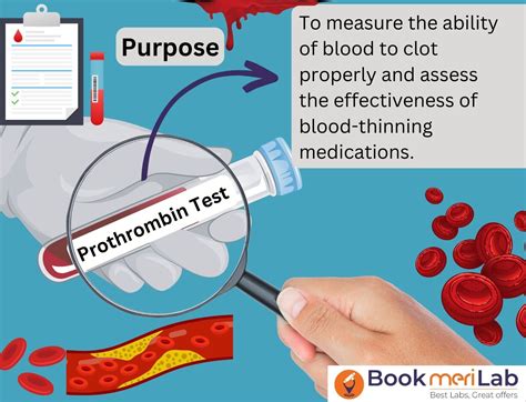 INR Blood Test Risks