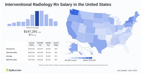 Interventional Radiology Nurse Salary by Employer