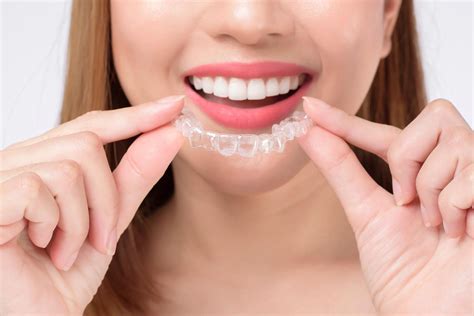 Invisalign