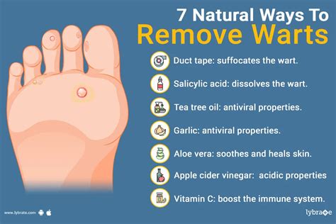 Irritation and inflammation for wart removal