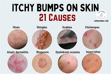 Itching and Rash
