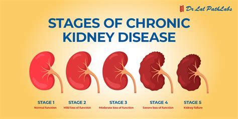 Kidney Problems