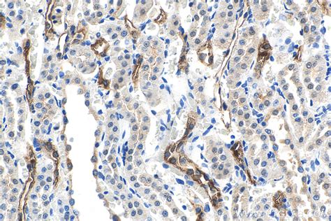 Kidney Researcher