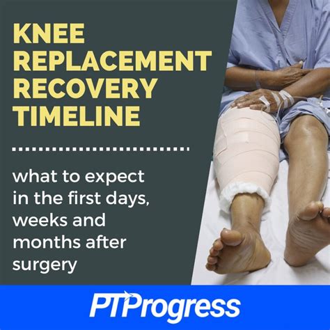 Knee Replacement Recovery Factors