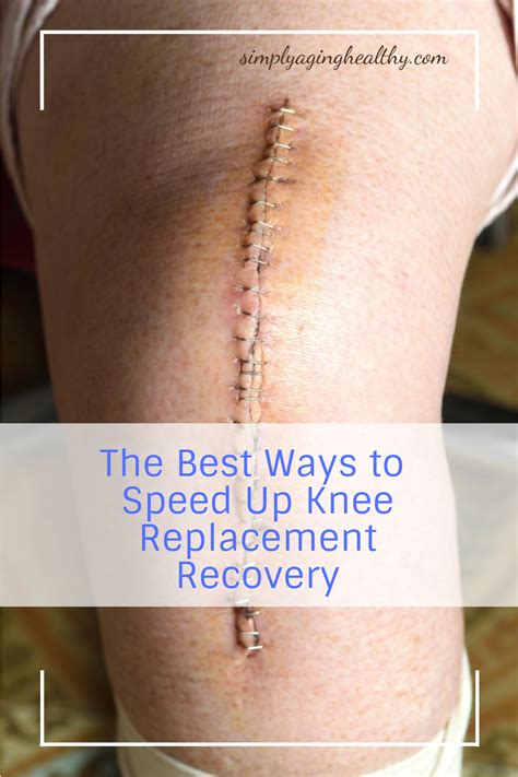 Knee Replacement Recovery Tips