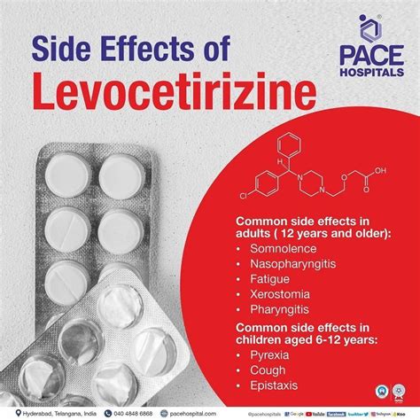 Levocetirizine side effects management