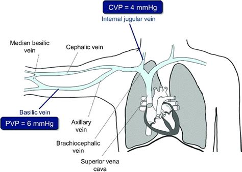 Limitations of CVP