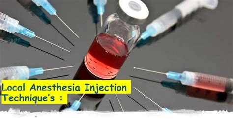 Localized Anesthesia Techniques