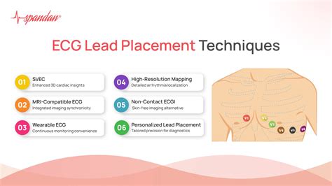 Mastering ECG Placement