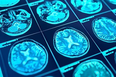 Medical Imaging Conclusion