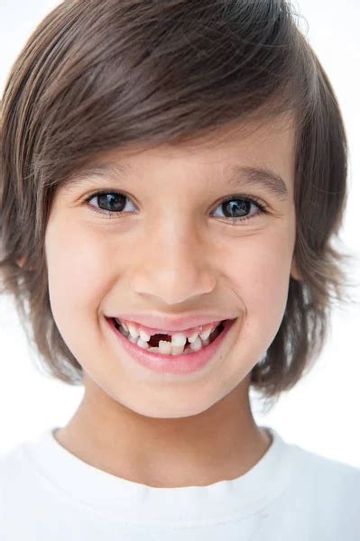 Missing Teeth