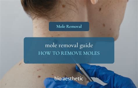 Mole removal techniques