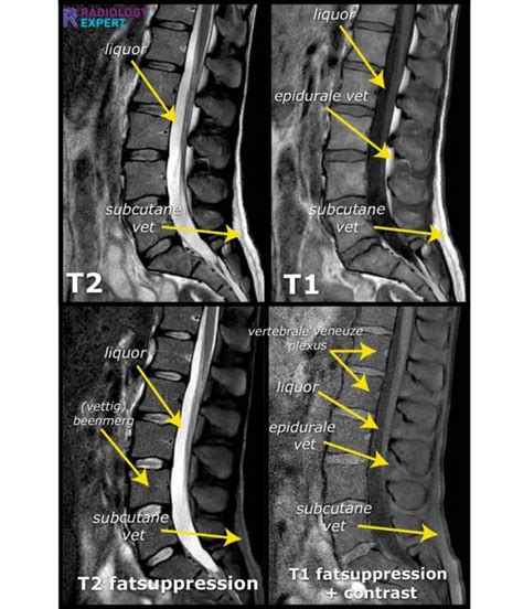 MRI Conditions
