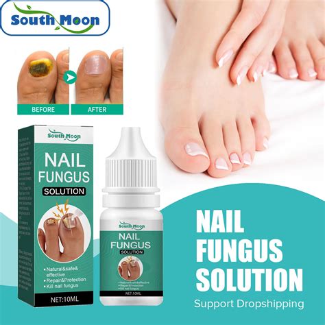 Treating nail fungus requires antifungal medications or topical creams