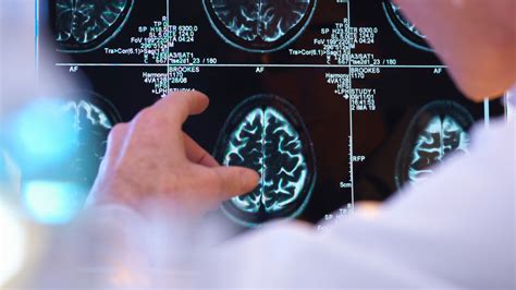 Neurological Services at Kaiser Permanente Anaheim Medical Center