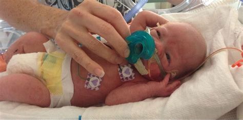 NICU Pain Management