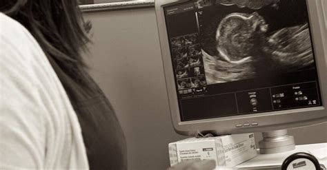 Ob-Gyn Sonographer Certifications