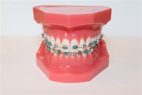 Orthodontics