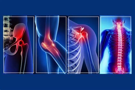 Orthopedic Services