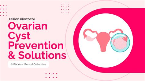 Ovarian Cyst Prevention