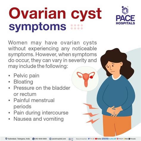 Ovarian Cyst Symptoms