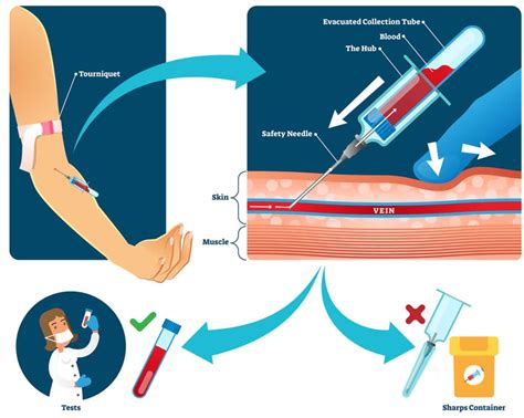 Phlebotomist