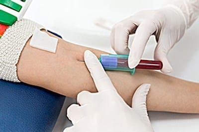 Phlebotomy career advancement