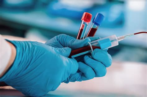Phlebotomy Job Opportunities in San Diego Laboratories