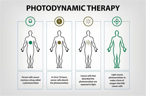 Photodynamic Therapy for Skin Cancer