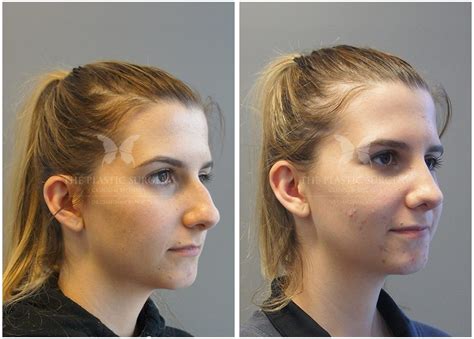 Plastic Surgery Jobs