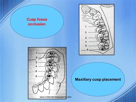 Posterior Fossa Occlusion
