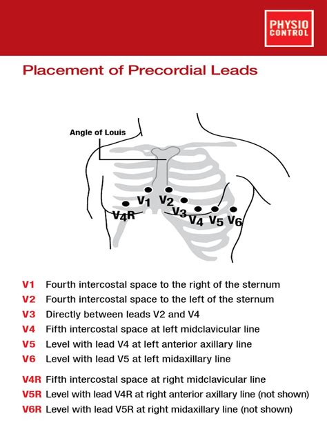 Precordial lead placement diagram