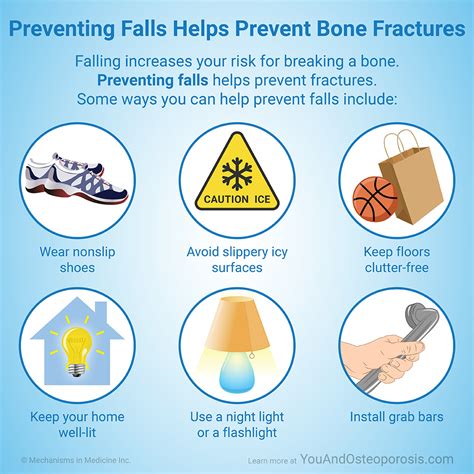 Preventing Leg Fractures
