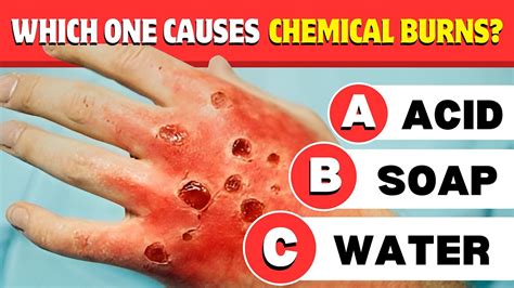 Preventing scarring from chemical burn