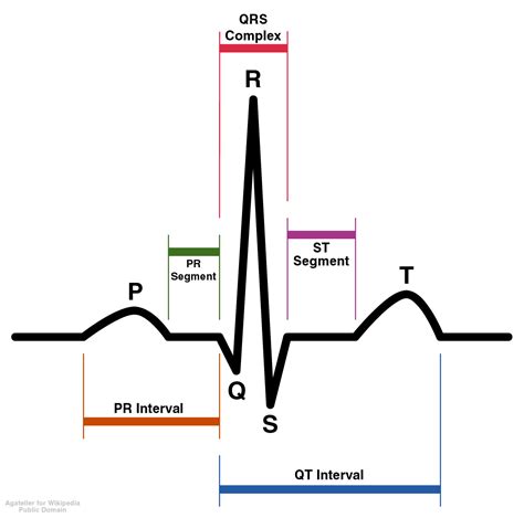 QT Interval