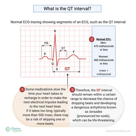 QT Interval Measurement