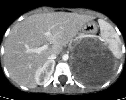 Radiology