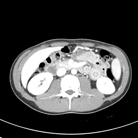 Radiology