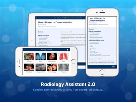 Radiology Assistant